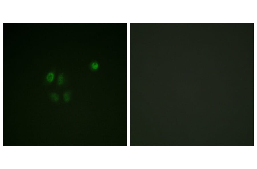 Immunofluorescence - Anti-Chk1 Antibody (B0862) - Antibodies.com