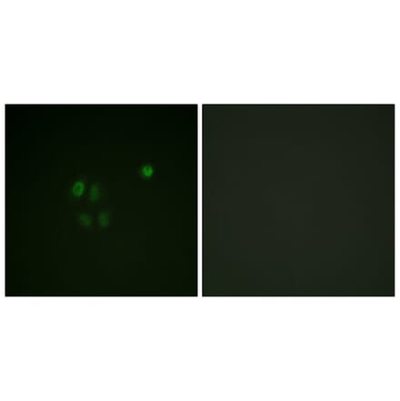 Immunofluorescence - Anti-Chk1 Antibody (B0862) - Antibodies.com