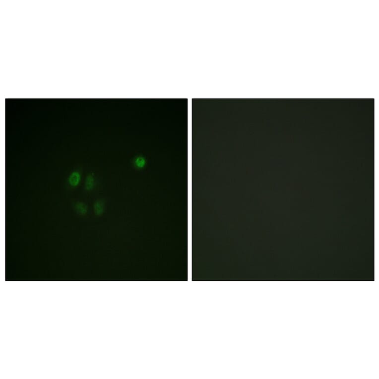 Immunofluorescence - Anti-Chk1 Antibody (B0862) - Antibodies.com