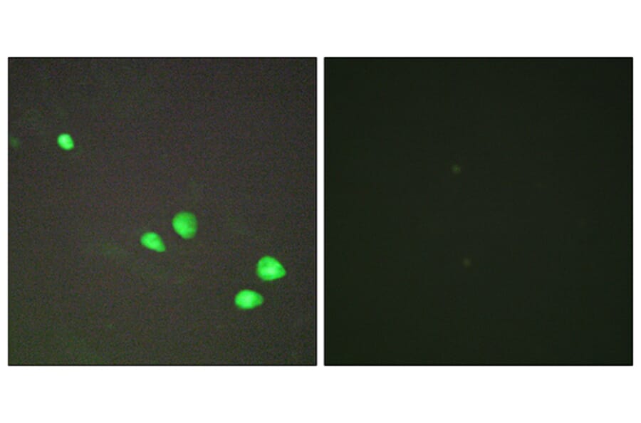 Immunofluorescence - Anti-CHD4 Antibody (C11048) - Antibodies.com