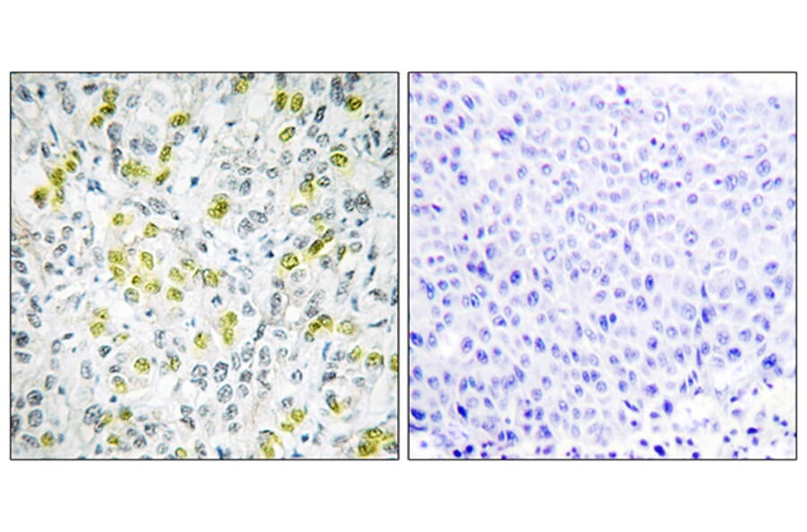 Immunohistochemistry - Anti-CHD4 Antibody (C11048) - Antibodies.com