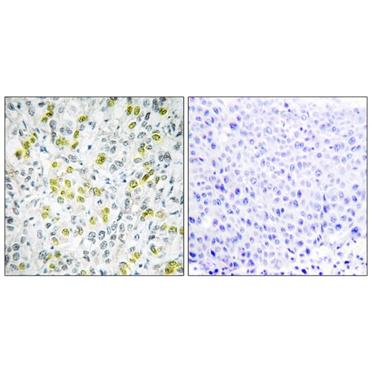 Immunohistochemistry - Anti-CHD4 Antibody (C11048) - Antibodies.com