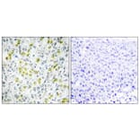 Immunohistochemistry - Anti-CHD4 Antibody (C11048) - Antibodies.com