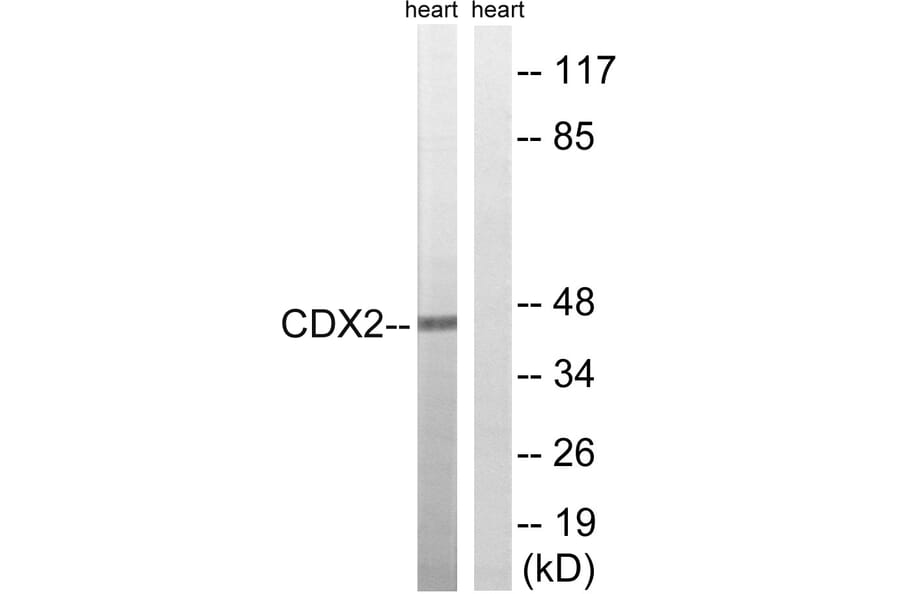 Western Blot - Anti-CDX2 Antibody (B8313) - Antibodies.com