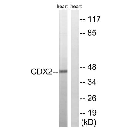 Western Blot - Anti-CDX2 Antibody (B8313) - Antibodies.com