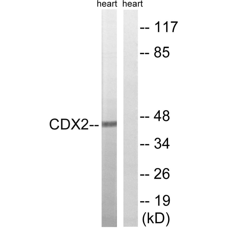 Western Blot - Anti-CDX2 Antibody (B8313) - Antibodies.com