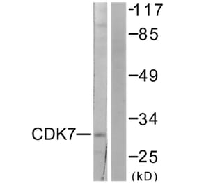Western Blot - Anti-CDK7 Antibody (C0353) - Antibodies.com