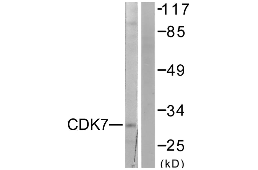 Western Blot - Anti-CDK7 Antibody (C0353) - Antibodies.com