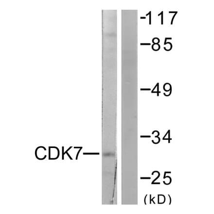 Western Blot - Anti-CDK7 Antibody (C0353) - Antibodies.com