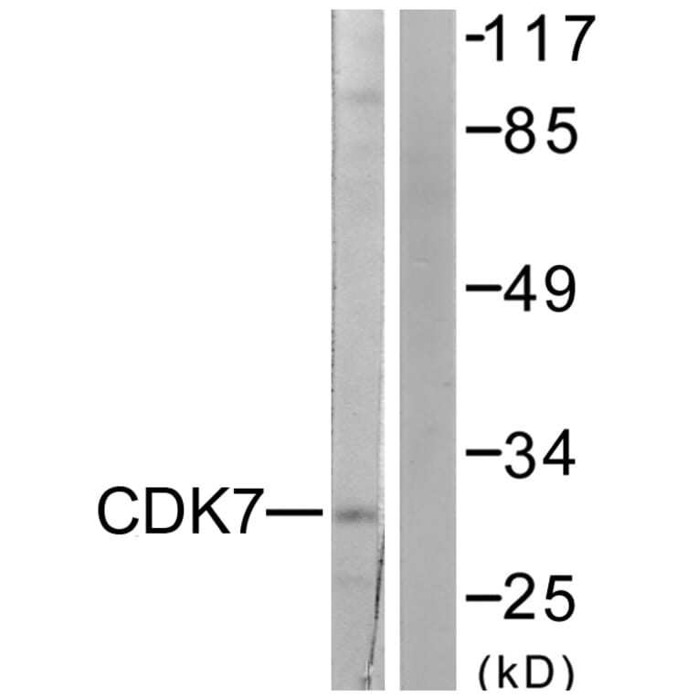 Western Blot - Anti-CDK7 Antibody (C0353) - Antibodies.com