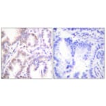 Immunohistochemistry - Anti-CDK7 Antibody (C0353) - Antibodies.com