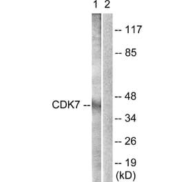 Western Blot - Anti-CDK7 Antibody (B0857) - Antibodies.com