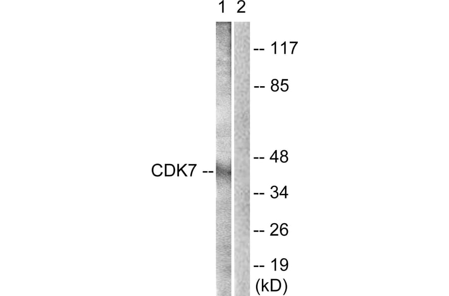 Western Blot - Anti-CDK7 Antibody (B0857) - Antibodies.com