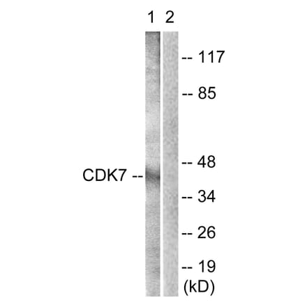 Western Blot - Anti-CDK7 Antibody (B0857) - Antibodies.com
