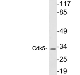 Western Blot - Anti-Cdk5 Antibody (R12-2088) - Antibodies.com