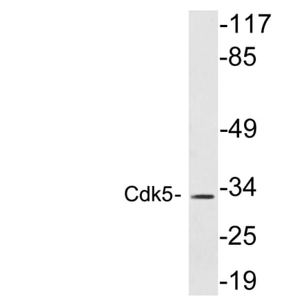 Western Blot - Anti-Cdk5 Antibody (R12-2088) - Antibodies.com