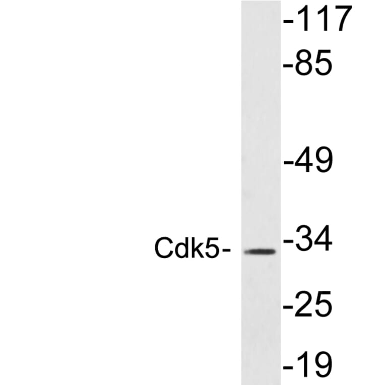 Western Blot - Anti-Cdk5 Antibody (R12-2088) - Antibodies.com