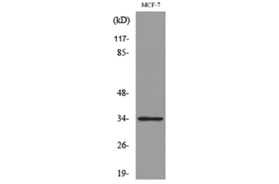 Western Blot - Anti-CDK4 Antibody (C30140) - Antibodies.com
