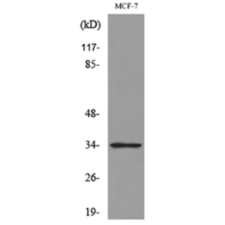 Western Blot - Anti-CDK4 Antibody (C30140) - Antibodies.com