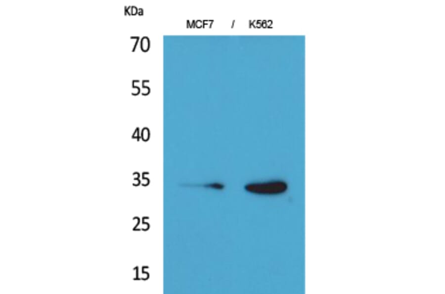 Western Blot - Anti-CDK4 Antibody (C30140) - Antibodies.com