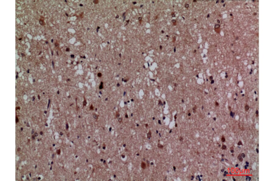 Immunohistochemistry - Anti-CDK4 Antibody (C30140) - Antibodies.com