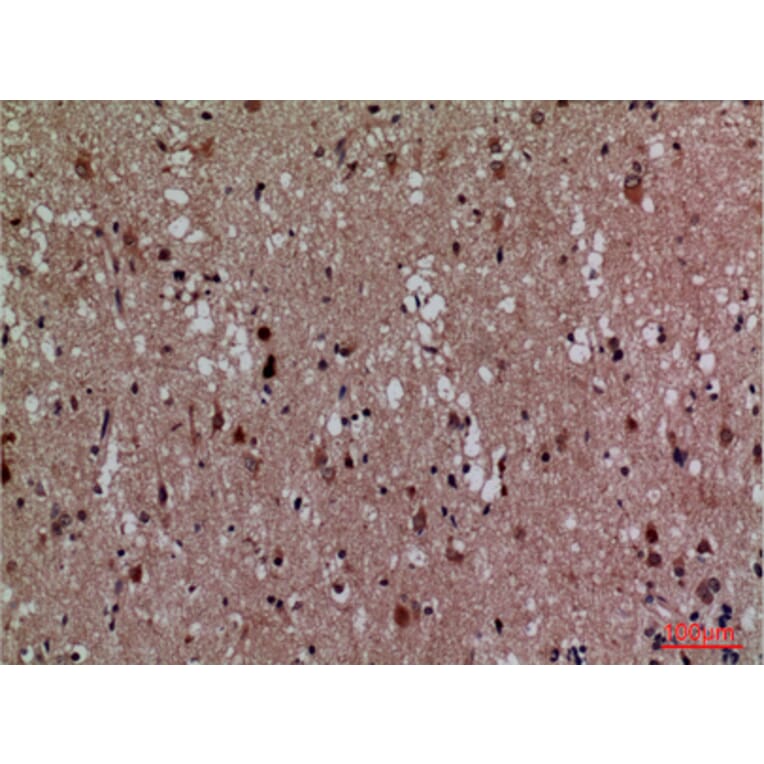 Immunohistochemistry - Anti-CDK4 Antibody (C30140) - Antibodies.com