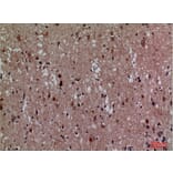 Immunohistochemistry - Anti-CDK4 Antibody (C30140) - Antibodies.com