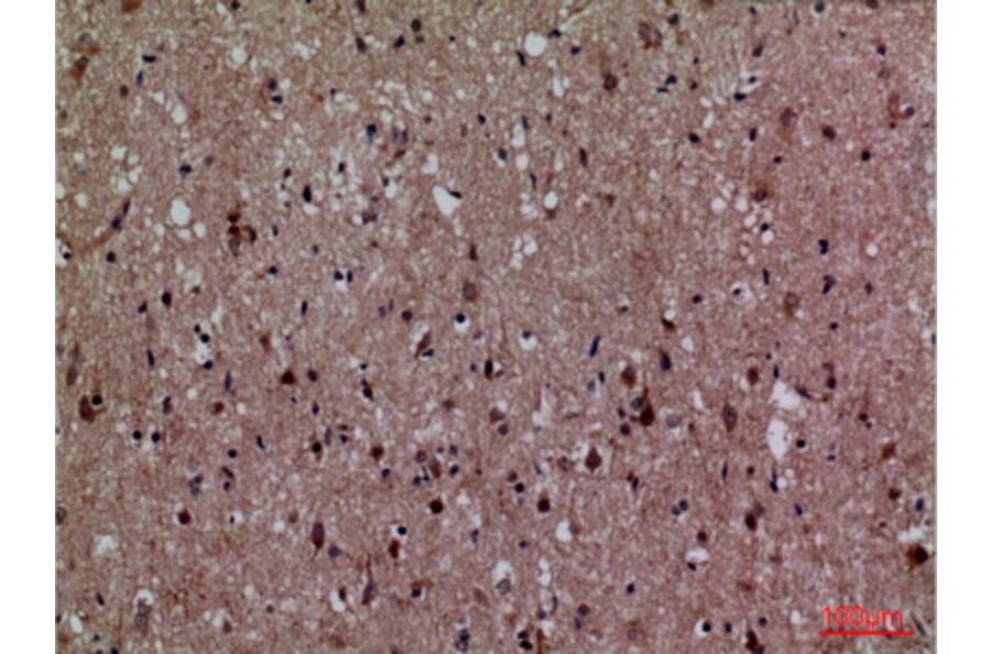 Immunohistochemistry - Anti-CDK4 Antibody (C30140) - Antibodies.com