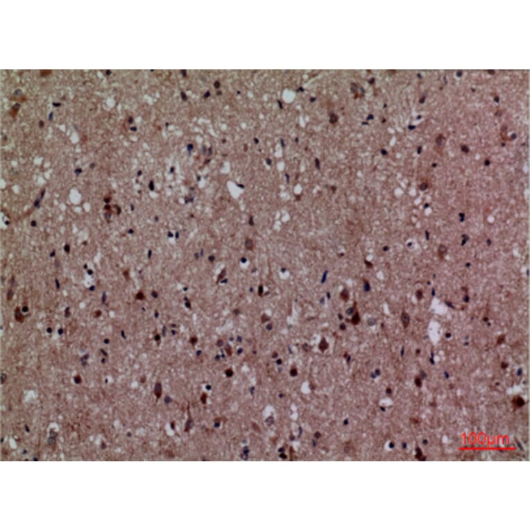 Immunohistochemistry - Anti-CDK4 Antibody (C30140) - Antibodies.com