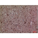 Immunohistochemistry - Anti-CDK4 Antibody (C30140) - Antibodies.com