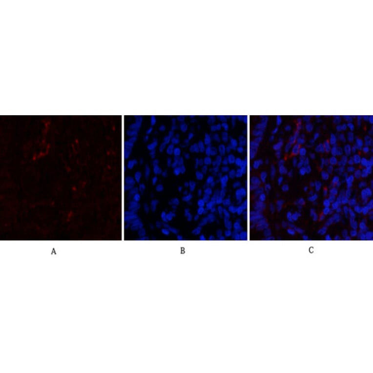 Immunofluorescence - Anti-CDK4 Antibody (C30140) - Antibodies.com