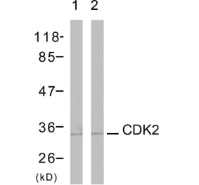 Western Blot - Anti-CDK2 Antibody (B7039) - Antibodies.com