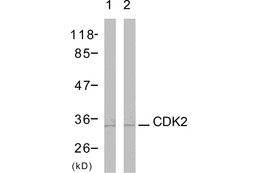 Western Blot - Anti-CDK2 Antibody (B7039) - Antibodies.com