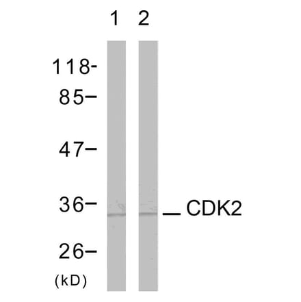 Western Blot - Anti-CDK2 Antibody (B7039) - Antibodies.com
