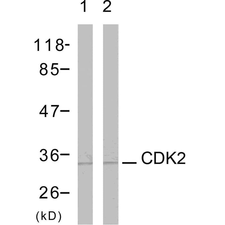 Western Blot - Anti-CDK2 Antibody (B7039) - Antibodies.com