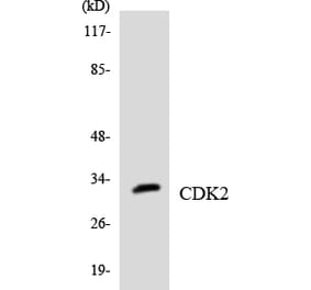 Western Blot - Anti-CDK2 Antibody (R12-2604) - Antibodies.com
