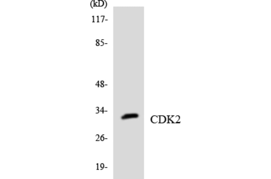 Western Blot - Anti-CDK2 Antibody (R12-2604) - Antibodies.com