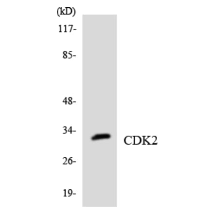 Western Blot - Anti-CDK2 Antibody (R12-2604) - Antibodies.com