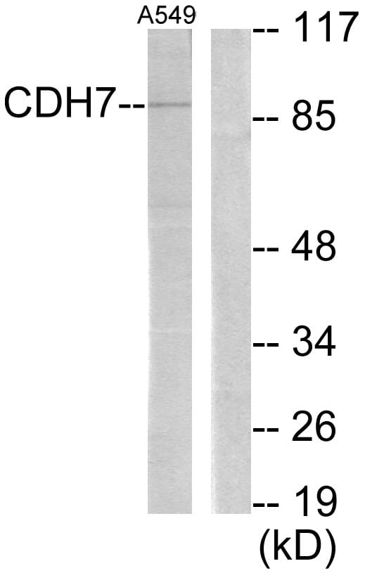Western blot analysis of lysates from A549 cells using Anti-CDH7 Antibody. The right hand lane represents a negative control, where the antibody is blocked by the immunising peptide.