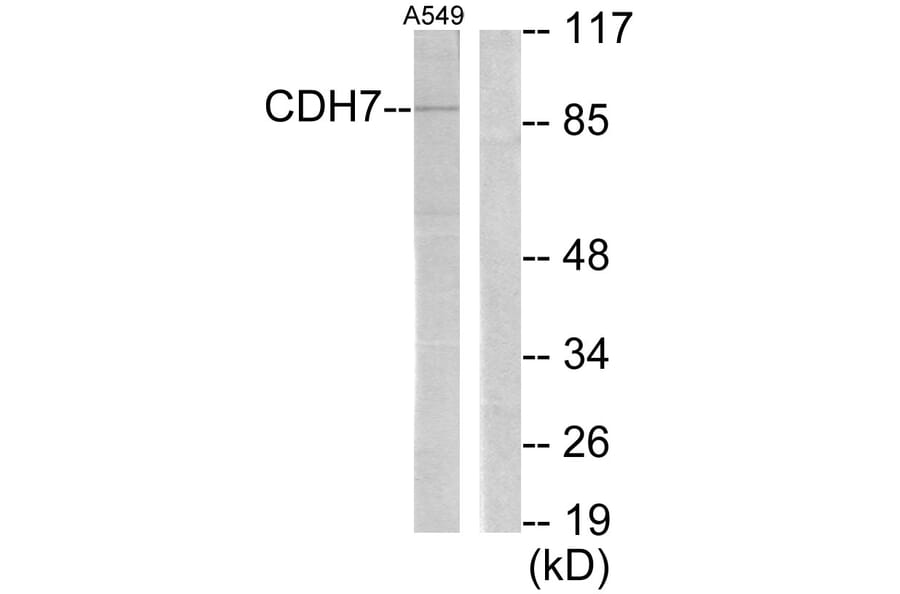 Western Blot - Anti-CDH7 Antibody (C12105) - Antibodies.com