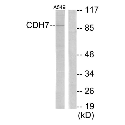 Western Blot - Anti-CDH7 Antibody (C12105) - Antibodies.com