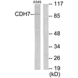 Western Blot - Anti-CDH7 Antibody (C12105) - Antibodies.com