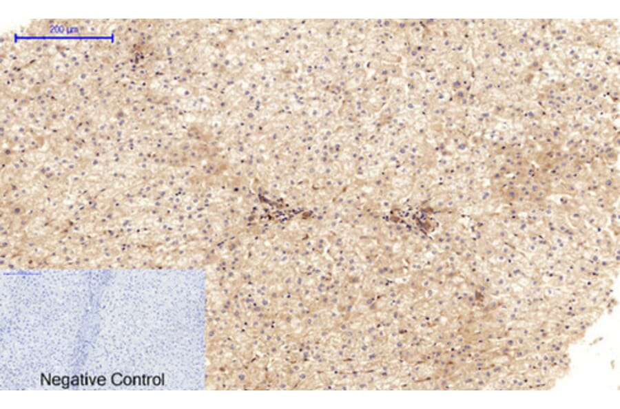 Immunohistochemistry - Anti-CDH5 Antibody (C30437) - Antibodies.com