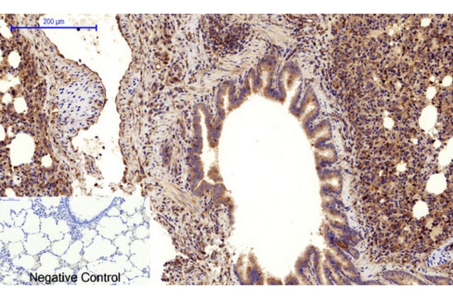 Immunohistochemistry - Anti-CDH5 Antibody (C30437) - Antibodies.com