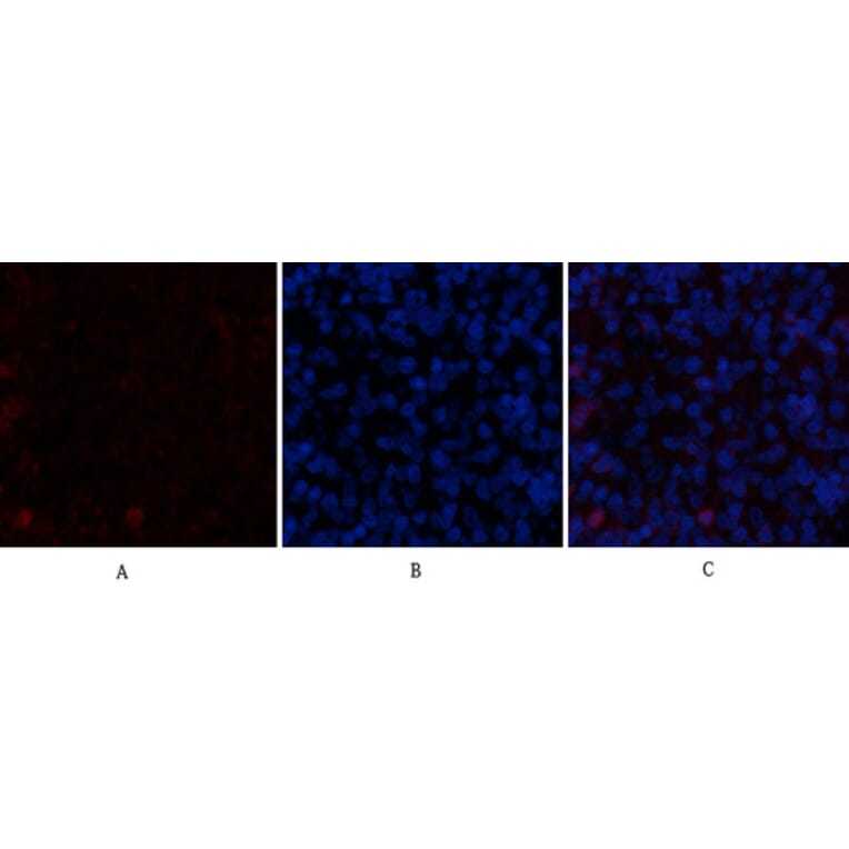 Immunofluorescence - Anti-CDH5 Antibody (C30437) - Antibodies.com