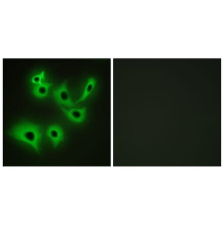 Immunofluorescence - Anti-CDH4 Antibody (C12102) - Antibodies.com