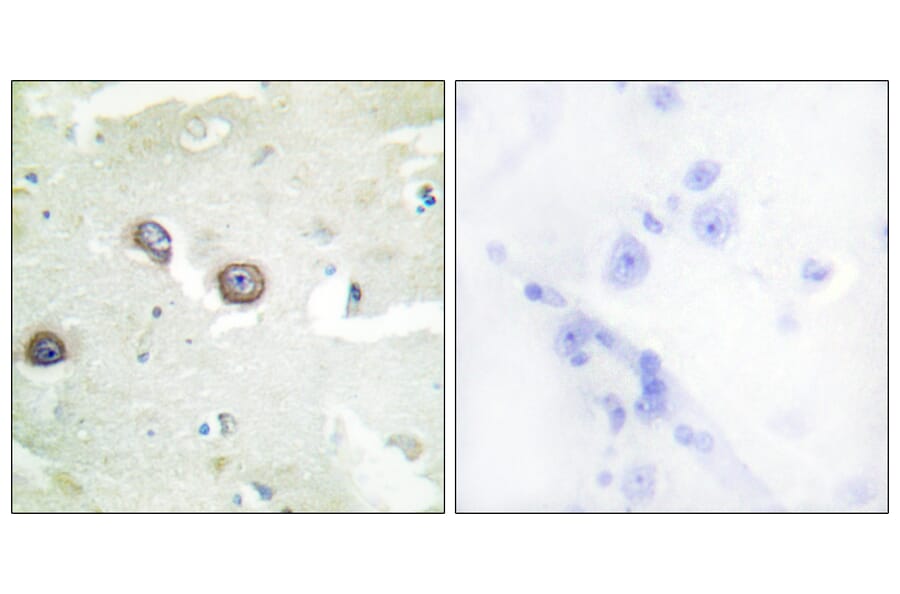 Immunohistochemistry - Anti-CDH4 Antibody (C12102) - Antibodies.com