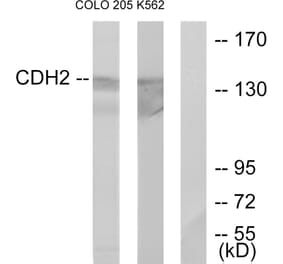 Western Blot - Anti-CDH2 Antibody (C12100) - Antibodies.com