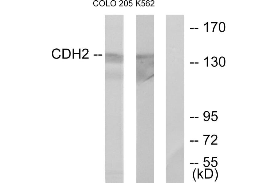 Western Blot - Anti-CDH2 Antibody (C12100) - Antibodies.com