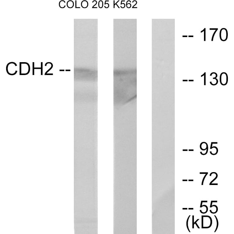 Western Blot - Anti-CDH2 Antibody (C12100) - Antibodies.com